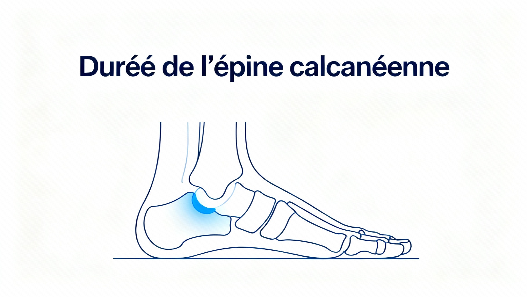Quelle est la durée d'une épine calcanéenne ? 1 Durée de l'épine calcanéenne